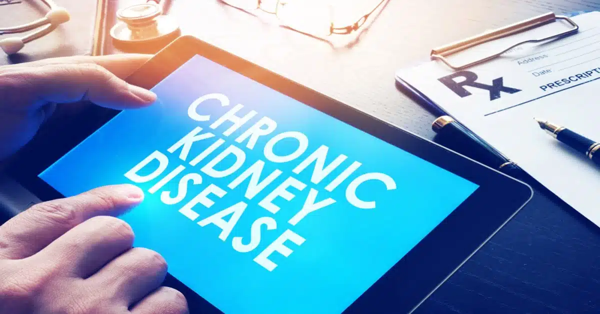 The Facts Surrounding The Coding Chronic Kidney Disease - Allzone