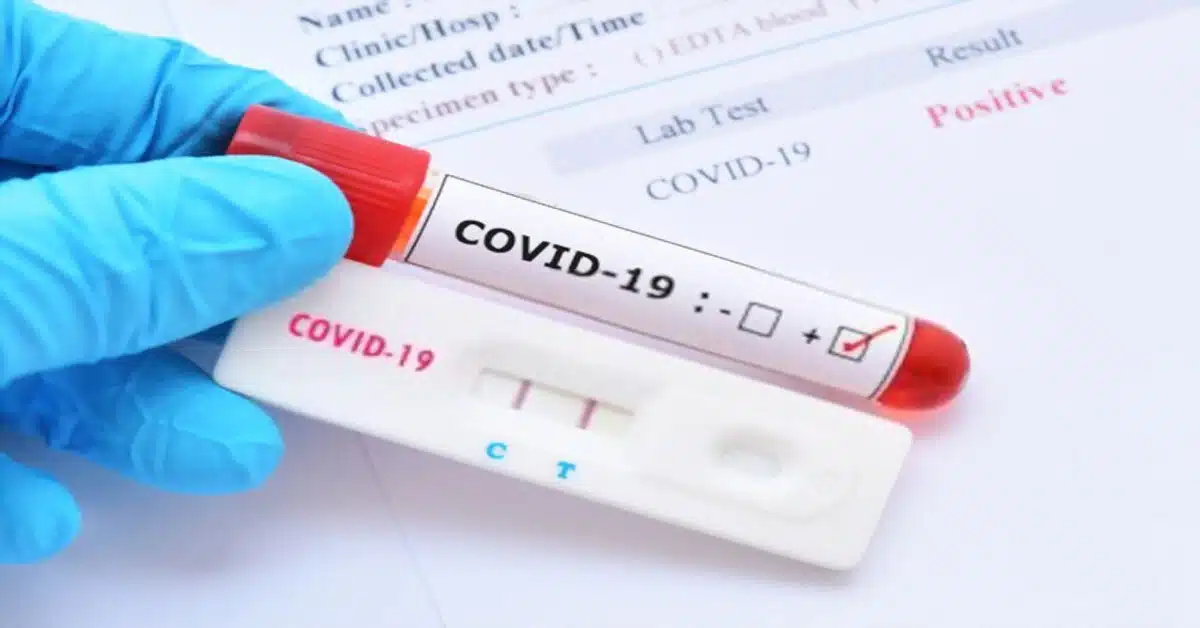 CPT Code for Coronavirus Testing